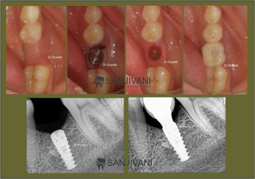 Brighten Your Smile in Rajkot: Real, Honest Insights Brighten Your Smile in Rajkot: Real, Honest Insights