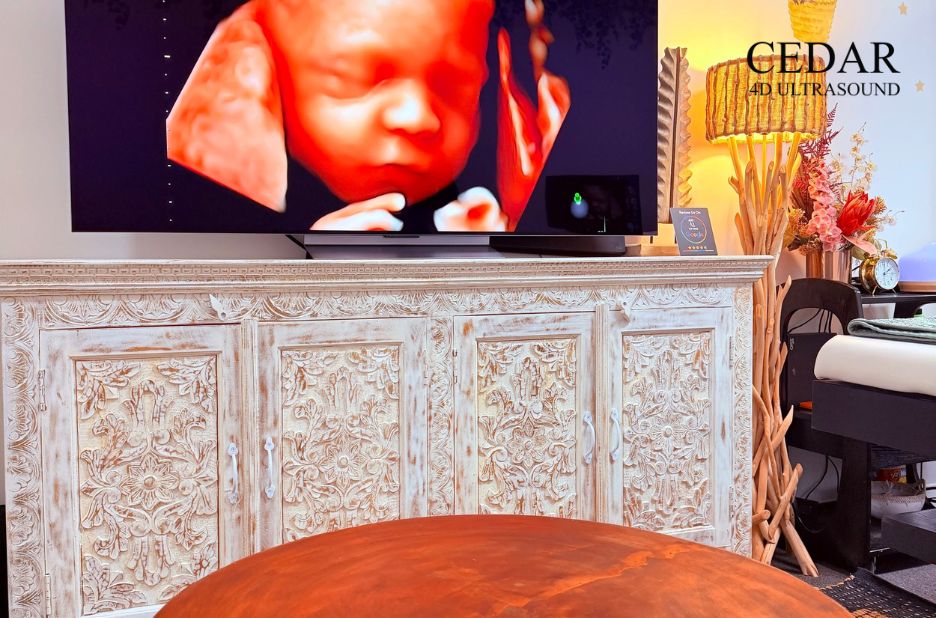 Comprehensive Ultrasound Packages for Expectant Families in Perth Comprehensive Ultrasound Packages for Expectant Families in Perth