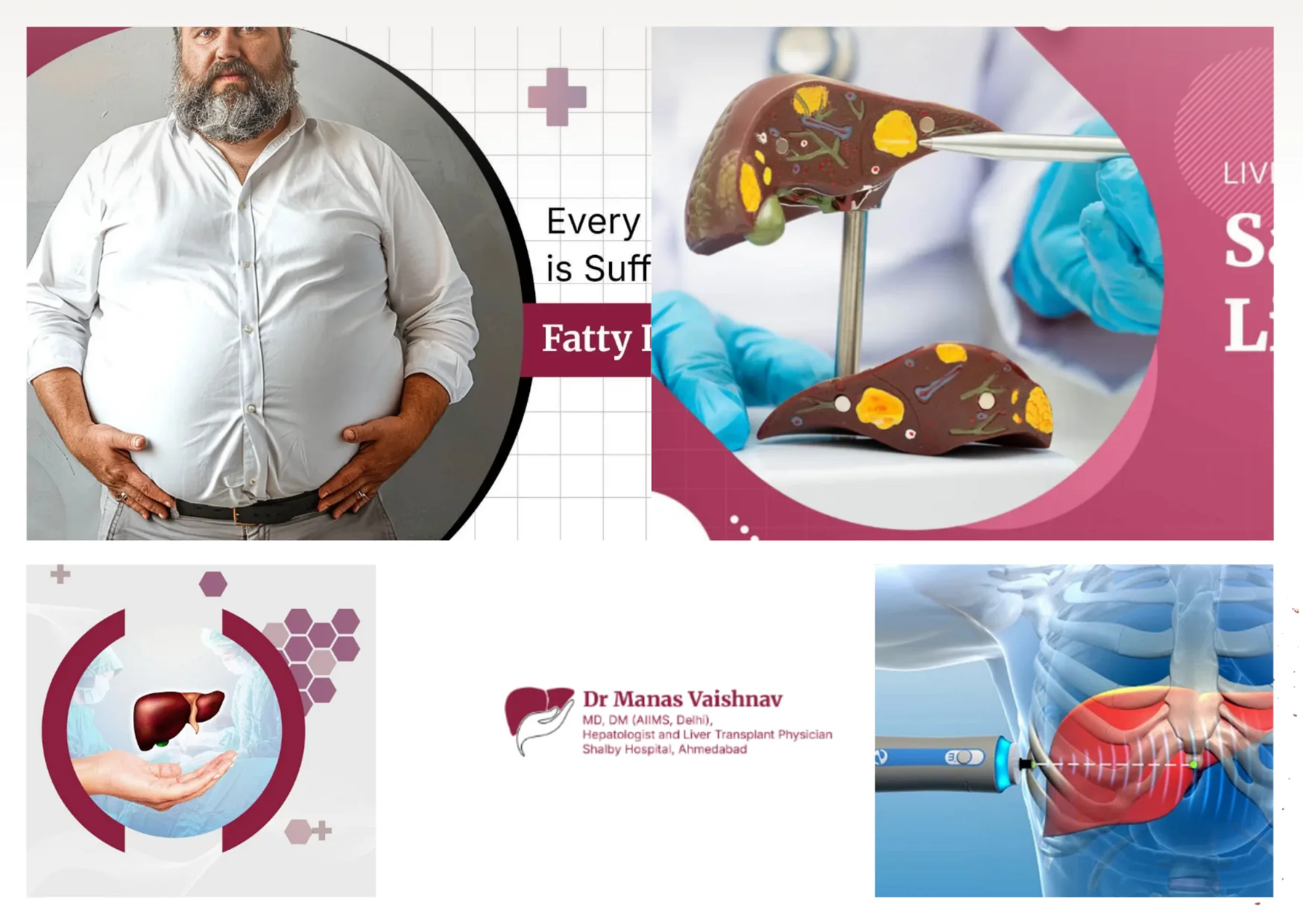 Top Best Gastroenterologist Ahmedabad for Expert Liver and GI Care Top Best Gastroenterologist Ahmedabad for Expert Liver and GI Care